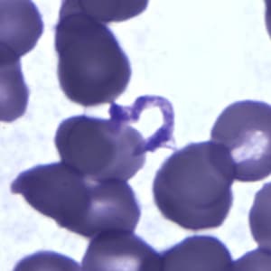 Figure D: Platelets in thin blood smears. The nature of the platelets gives them the appearance of trypomastigotes of <em>Trypanosoma cruzi</em>.