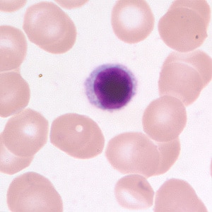 Figure D: Small lymphocyte in a thin blood smear, stained with Giemsa.