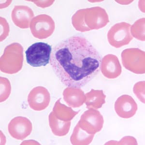 Figure E: Small lymphocyte (left) and neutrophil in a thin blood smear, stained with Giemsa.