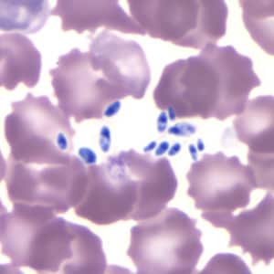 Figure A: Unidentified objects (probably fungal) in a thin blood smear, stained with Giemsa. Such objects may be confused for amastigotes of <em>Leishmania</em> or <em>Trypanosoma cruzi</em>, but the lack of a distinct nucleus and kinetoplast should rule-out these parasites.