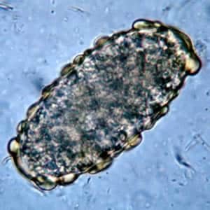 Figure A: Unfertilized egg of <em>A. lumbricoides</em>. Note the prominent mammillations on the outer layer.