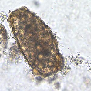 Figure B: Unfertilized egg of <em>A. lumbricoides</em> in an unstained wet mount, 200x magnification.