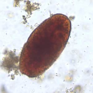 Figure D: Unfertilized egg of <em>A. lumbricoides</em> in a wet mount of stool. Note this specimen lacks the mammillated layer (decorticated).