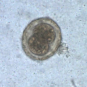 Figure B: Fertilized egg of <em>A. lumbricoides</em> in unstained wet mounts of stool, with embryos in the early stage of development.