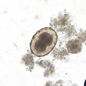 Figure C: Fertilized egg of <em>A. lumbricoides</em> in an unstained wet mount of stool, undergoing early stages of cleavage. Image taken at 200x magnification.