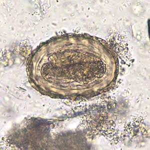 Figure E: Fertilized egg of <em>A. lumbricoides</em> in an unstained wet mount of stool, 200x magnification. A larva is visible in the egg.