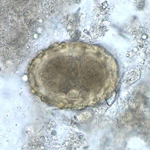 Figure A: Fertilized egg of <em>A. lumbricoides</em> in unstained wet mounts of stool, with embryos in the early stage of development.