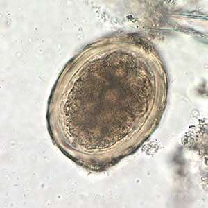 Figure D: The same egg as in Figure C, but at 400x magnification.