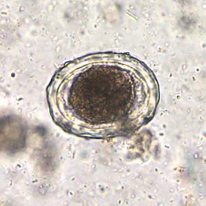 Figure A: <em>A. lumbricoides</em> decorticated, fertile egg in wet mounts, 200x magnification.