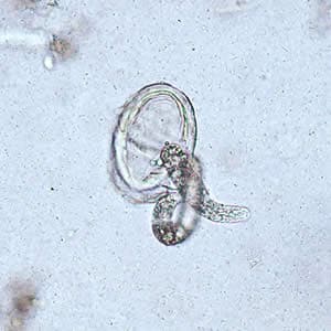 ascaris embrió