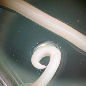 Figure D: Posterior end of a male <em>A. lumbricoides</em>, showing the curled tail.