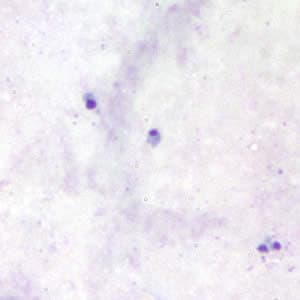 Figure B: <em>Babesia</em> sp. in thick blood smears stained with Giemsa.