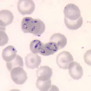 Figure A: <em>Babesia</em> sp. in a thin blood smear stained with Giemsa.
