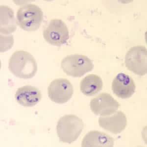 Figure C: <em>Babesia</em> sp. in a thin blood smear stained with Giemsa.