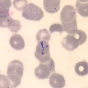 Figure A: <em>Babesia</em> sp. in a thin blood smear stained with Giemsa. Note the tetrads, a dividing form characteristic for <em>Babesia</em>.