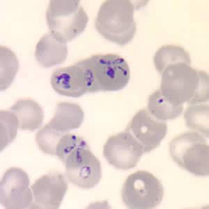 Figure B: <em>Babesia</em> sp. in a thin blood smear stained with Giemsa. Note the tetrads, a dividing form characteristic for <em>Babesia</em>.