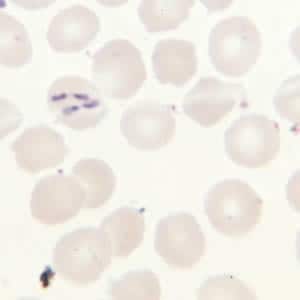Figure D: <em>Babesia</em> sp. in a thin blood smear; tetrad form, pairs aligned.