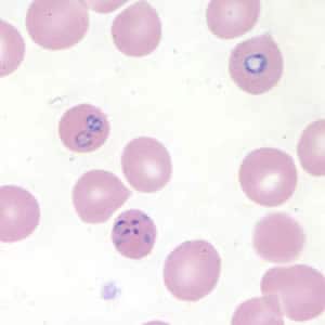 Figure A: <em>Babesia duncani</em> in a thin blood smear stained with Giemsa. Babesia sp. cannot be identified to the species level by morphology alone; additional testing, such as PCR, is always recommended.