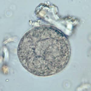 Figure A: <em>B. coli</em> cyst in a wet mount, unstained.