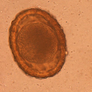 Figure A: Unembryonated egg of <em>B. procyonis</em>