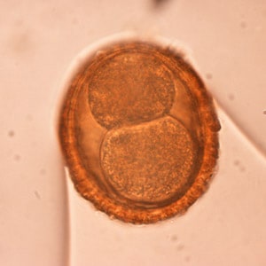 Figure B: Egg of <em>B. procyonis</em>. In this specimen, the developing embryo has started to divide.