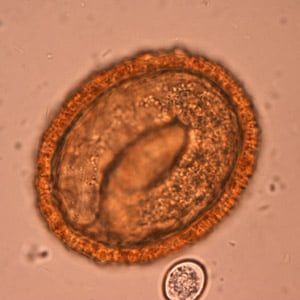 Figure E: Embryonated eggs of<em> B. procyonis</em>, showing the developing larva inside.