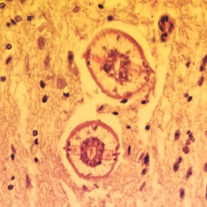 Figure A: Cross-sections of larvae of <em>B. columnaris</em> in the brain of a laboratory-infected mouse. The larval morphology and microscopic manifestations are essentially identical to <em>B. procyonis</em>. Image taken at 400x magnification.