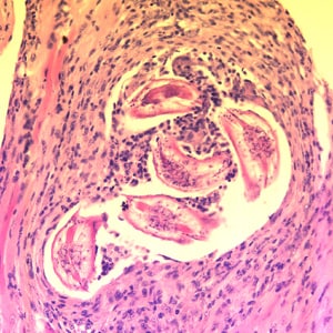 Figure C: Cross-sections of larvae of <em>B. columnaris</em> in muscle of a laboratory-infected mouse. The larval morphology and microscopic manifestations would be similar with <em>B. procyonis</em> in human tissue. Image taken at 400x magnification.