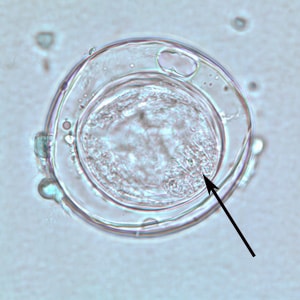 Figure C: An egg of <em>Bertiella</em> sp. liberated from a gravid proglottid. The arrows point to the hooklets.