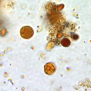 blastocystis hominis parazita
