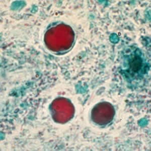 blastocystis hominis bél paraziták