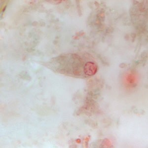 Figure A: Trophozoite of <em>C. mesnili</em> from a stool specimen, stained with trichrome. Image taken at 1000x magnification.