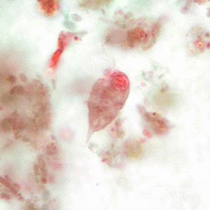 Figure B: Trophozoite of <em>C. mesnili</em> from a stool specimen, stained with trichrome. Image taken at 1000x magnification.