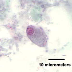 Figure D: Trophozoite of <em>C. mesnili</em> from a stool specimen, stained with trichrome. Image taken at 1000x magnification.