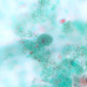 Figure A: Cyst of <em>C. mesnili</em> in a stool specimen, stained with trichrome. Image taken at 1000x magnification.