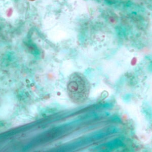 Figure B: Cyst of <em>C. mesnili</em> in a stool specimen, stained with trichrome. Image taken at 1000x magnification.