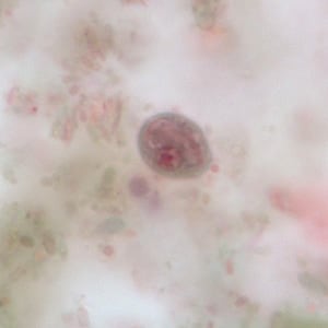 Figure C: Cyst of <em>C. mesnili</em> in a stool specimen, stained with trichrome. Image taken at 1000x magnification.