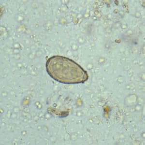 BNO – Fertőző és parazitás betegségek - Fascioliasis opisthorchiasis clonorchiasis