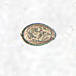 Figure B: <em>C. sinensis</em> egg. Note the operculum resting on 