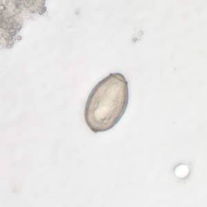 Figure C: <em>C. sinensis</em> egg; image taken at 400× magnification.