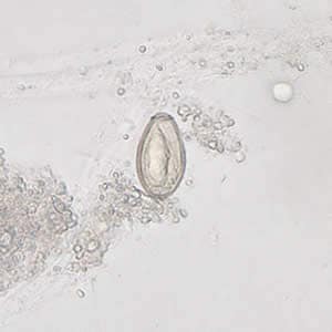 Figure D: <em>C. sinensis</em> egg; image taken at 400× magnification.