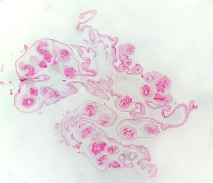 Figure A: Coenurus removed from a subcutaneous nodule on the leg of a patient, stained with hematoxylin and eosin (H&E). Image taken at ~30x magnification. 