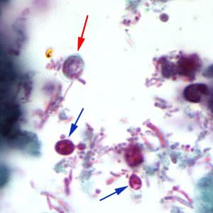 Figure B: <em>Cryptosporidium</em> sp. oocyst stained with trichrome. Oocysts may be detected, but should not be confirmed by this method. Trichrome staining is inadequate for a definite diagnosis because oocysts will appear unstained. Here the <em>Cryptosporidium</em> oocyst is represented by a red arrow; the blue arrows represent yeast.