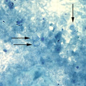 Figure B: Unstained <em>Cryptosporidium</em> sp. oocysts (black arrows) on a slide stained with modified acid-fast. The slide was counterstained with malachite green.