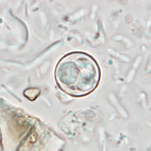 Figure C: Oocyst of <em>C. cayetanensis</em> in an unstained wet mount of stool. Image taken at 1000x magnification.