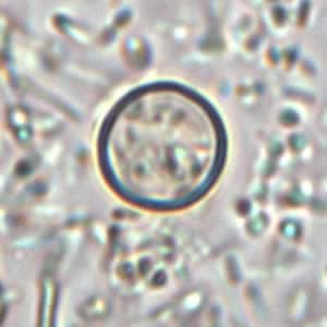 Figure A: Oocyst of <em>C. cayetanensis</em> in an unstained wet mount. Image courtesy of the Oregon State Public Health Laboratory.