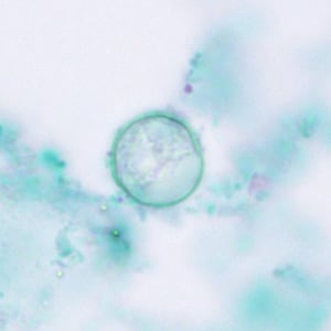 Figure B: Oocysts of <em>C. cayetanensis</em> stained with trichrome; while the oocyst is visible, the staining characteristics are inadequate for a reliable diagnosis.