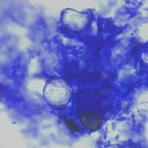 Figure C: Oocysts of <em>C. cayetanensis</em> stained with modified acid-fast stain. Note the wrinkled edge and the lack of stain in the two oocysts. Image courtesy of the Arizona State Public Health Laboratory.
