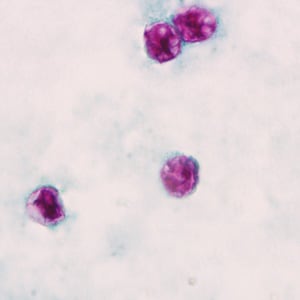 Figure F: Oocysts of <em>C. cayetanensis</em> stained with modified acid-fast stain.