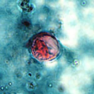 Figure A: Oocyst of <em>C. cayetanensis</em> stained with safranin (SAF).